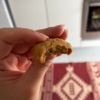 Eti Gıda Üründen Saç Çıktı