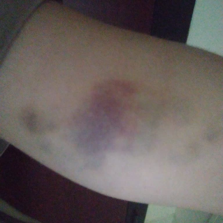 Aile Sağlığı Merkezleri Hançerli Sağlık Ocağı Kan Verme Sorunu