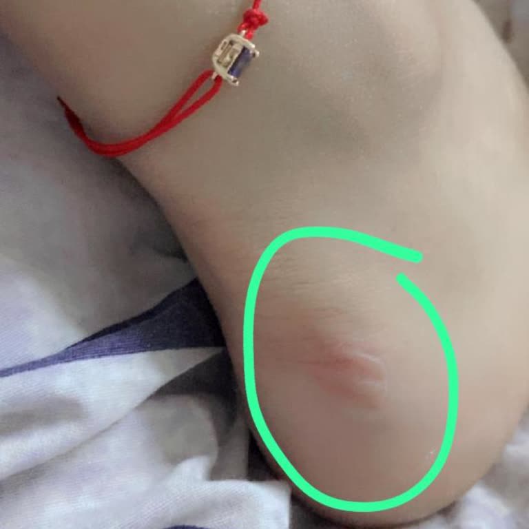 Deichmann Ürün İade Süreci