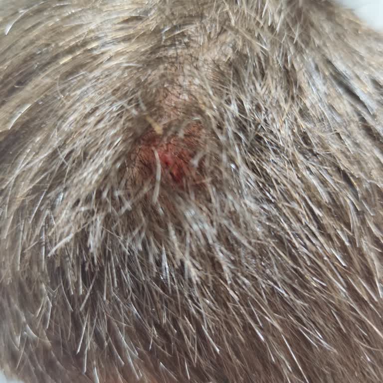 Otacı Şampuan Saç Derimde Yara Yaptı.