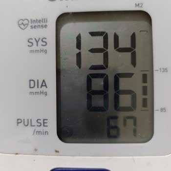 Saat Adam Electro-2 Yanlış Ölçüyor