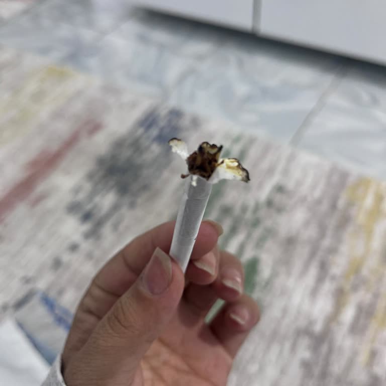 Philip Morris Sigara Patlaması Yanığı