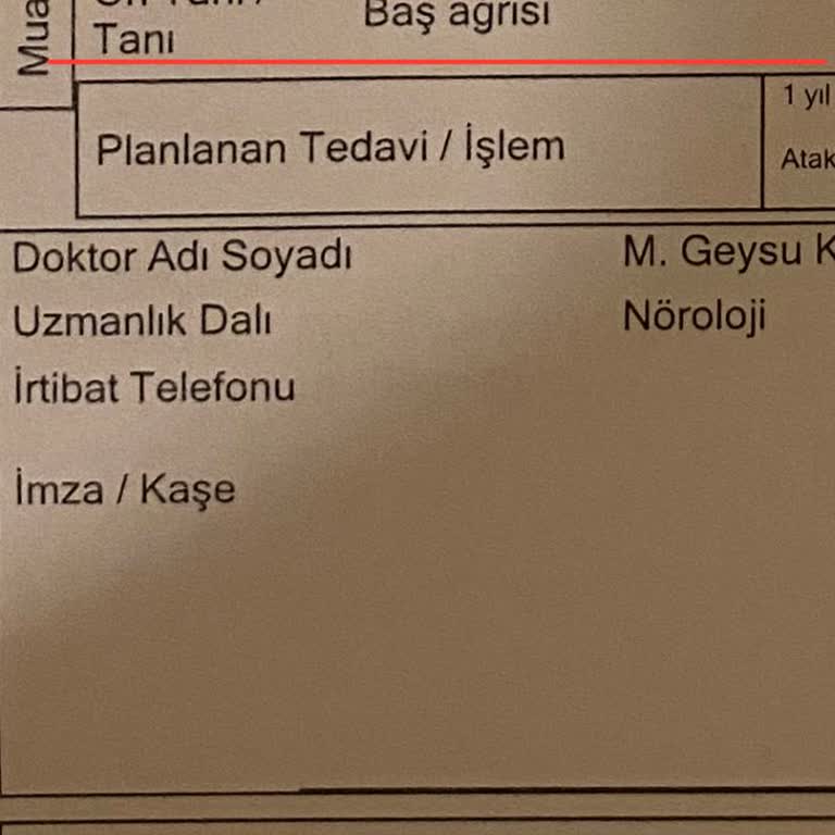 Anadolu Sigorta Tss Baş Ağrısı Muayenesini Karşılamadı!