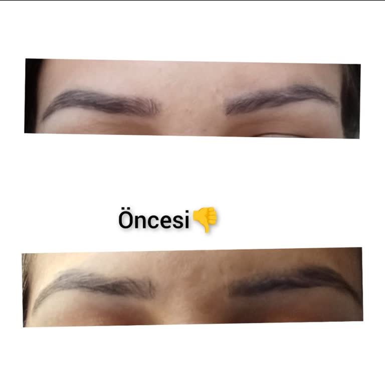 Koçak Brows Kıl Tekniği Kaş İşleminde Hayal Kırıklığı Ve Müşteri Memnuniyetsizliği