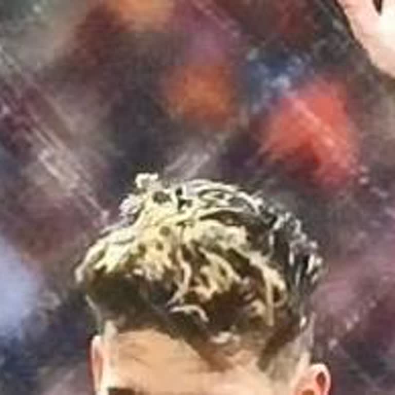 Tod TV Ve Bein Sports1 De Ekranda Izgara Şeklinde Çizgiler Beliriyor