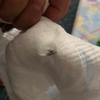 Molfix Bebek Bezi İçinden Siyah Cisim