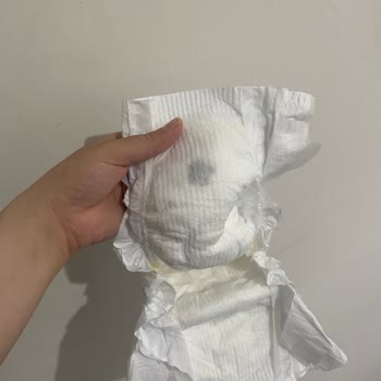 Molfix Bebek Bezinden Çıkan