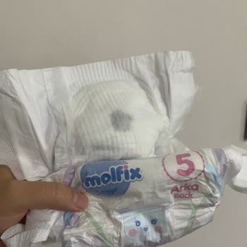 Molfix Bebek Bezinden Çıkan
