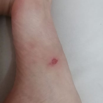 Muya'dan Aldığım Yüksek Taban Terliğin Ayaklarımı Mahvetmesi