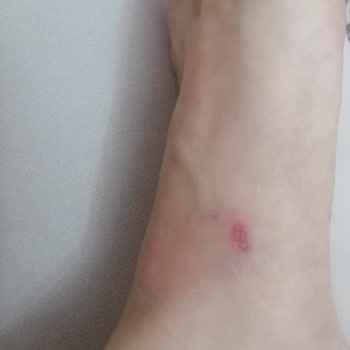 Muya'dan Aldığım Yüksek Taban Terliğin Ayaklarımı Mahvetmesi