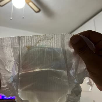 Molfix Pişik Ve Yabancı Cisim