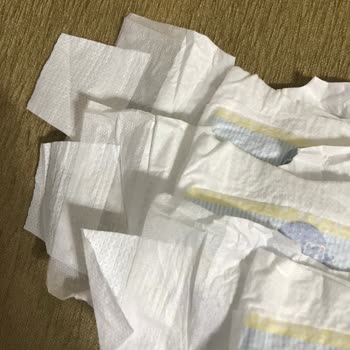 Molfix Bebek Bezi Deforme