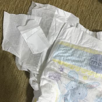 Molfix Bebek Bezi Deforme