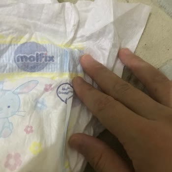 Molfix Bebek Bezi Deforme