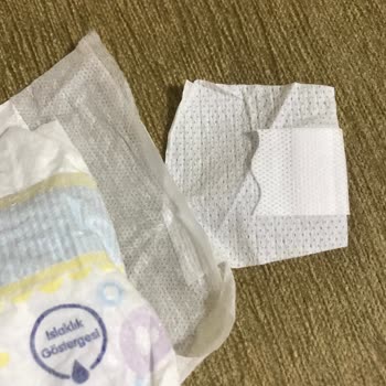 Molfix Bebek Bezi Deforme