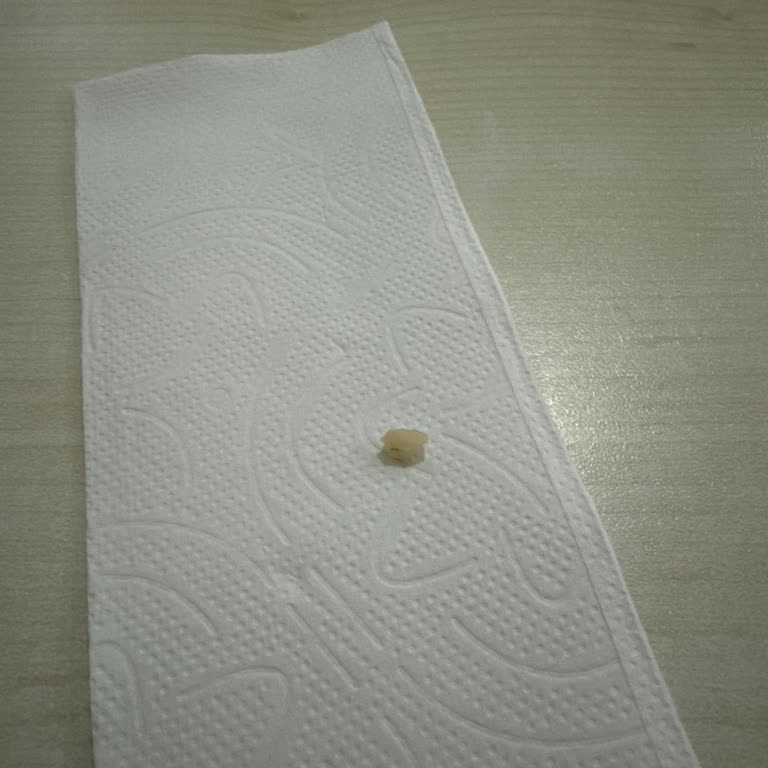 Biruni Üniversitesi Diş Hastanesi Estetik Dolgu Tedavisinde Yaşadığım Sorunlar