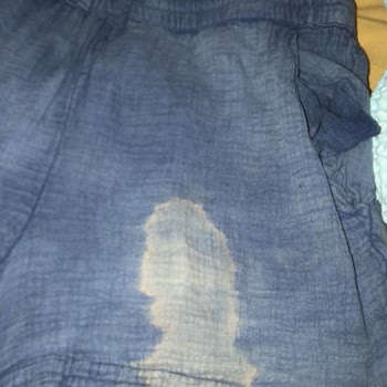 Kuaför Mehmet Yalçınkaya Saçımı Ve Kıyafetlerimi Mahvetti!