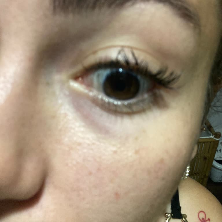 Hebe Med Güzellik Salonu Kalitesiz Malzeme Kullanımı!