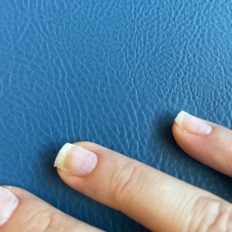 Moncheri Nail Art'ta Tırnak Mantarı Kaptım!