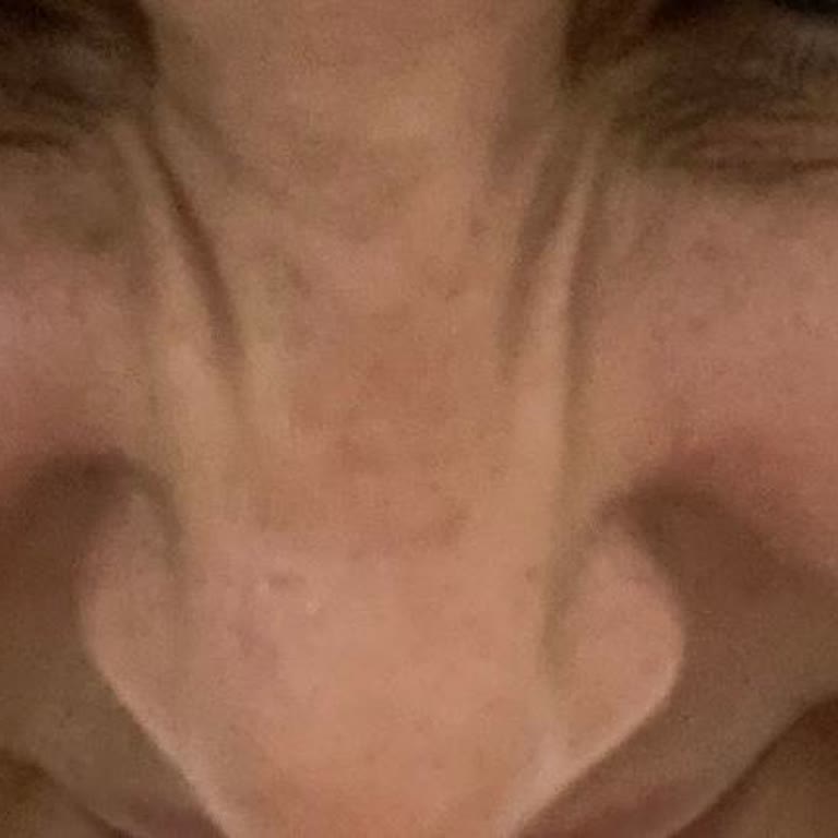 Bk Aesthetic (Berke Kılıç) Şikayetçiyim