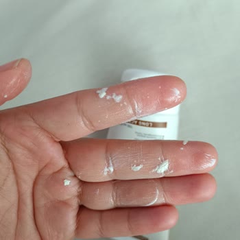 Solante Güneş Kremi Beyaz Tortu Bırakıyor Yüzde