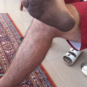 Deichmann Aldığım Terlik Ayağımda Siyah İz Bıraktı Ve İade Talebim Reddedildi