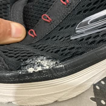 Skechers Ayakkabı Deforme İlgisizlik