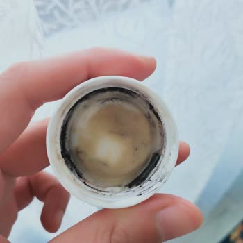 Ganik Siyah Madde Nedir Küf Mü