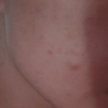 Boyner Online Mağazadan Aldığım Estee Lauder Ürünleri Sivilce Yaptı!