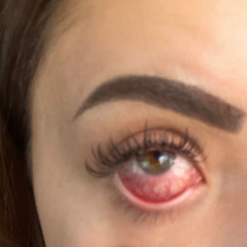 Nç Beauty Center İpek Kirpik Gözlerimi Mahvetti