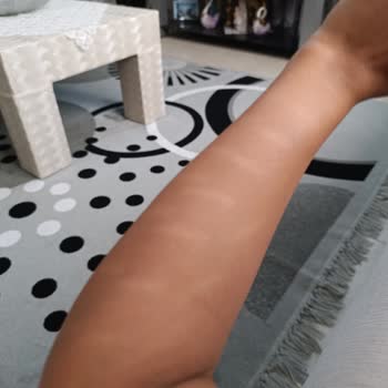 PHILIPS Ev Aletleri Philips Lumea Kolumu Yaktı
