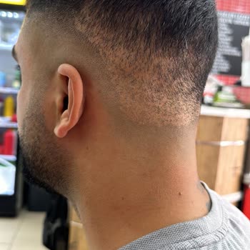 Serkan Aydın Saç Ekimi İptal Ettirdiğim Saç Ekim İşlemi Öncesinde Kaporanın İade Edilmemesi!