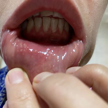 Sensodyne Hassas Dişler İçin Olan Macunu Kullandım Ve Sonuç