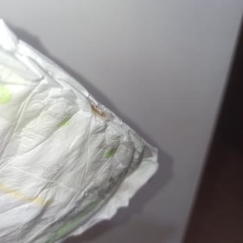 Konu: Sleepy Markalı Bezlerde Yaşanan Ciddi Sorun