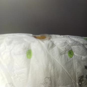 Konu: Sleepy Markalı Bezlerde Yaşanan Ciddi Sorun