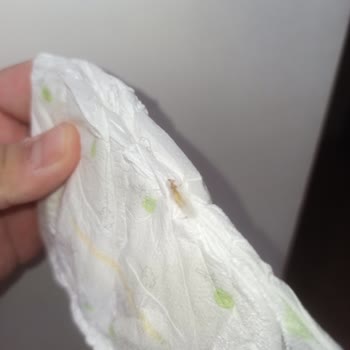 Konu: Sleepy Markalı Bezlerde Yaşanan Ciddi Sorun