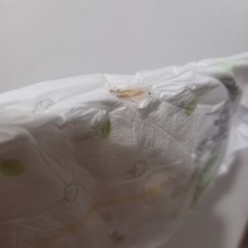 Konu: Sleepy Markalı Bezlerde Yaşanan Ciddi Sorun