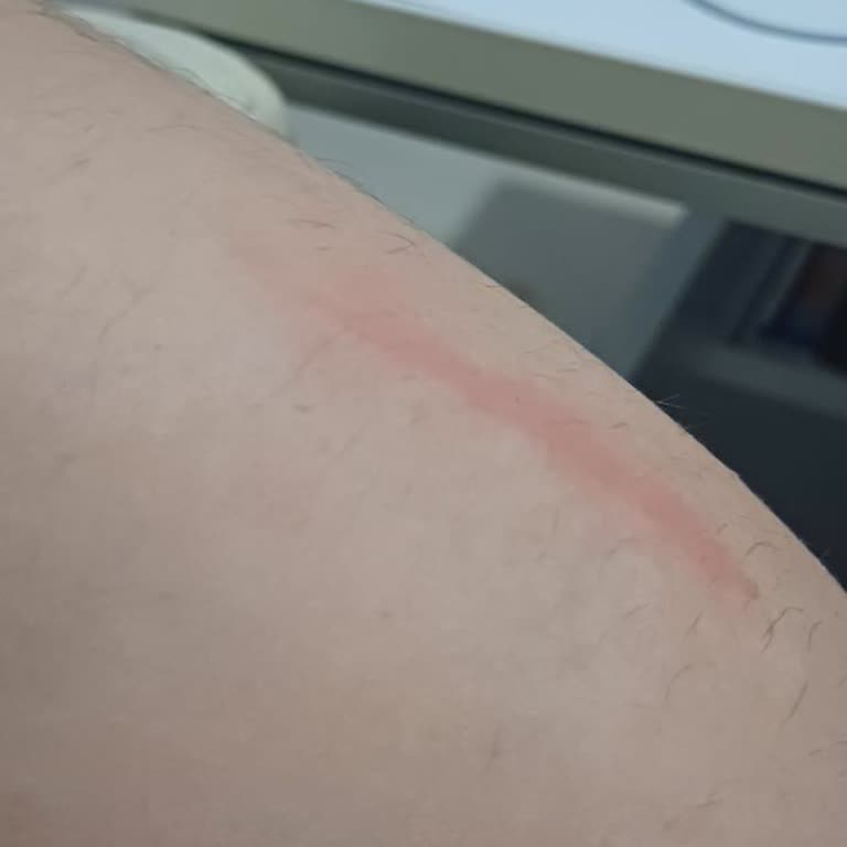 Monster Abra A5 V17.2 Şarj Aleti Bataryası İnanılmaz Isındı