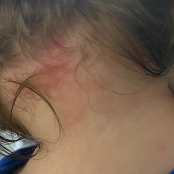 Medical Park Hastanesi Kocaeli Hastanesi İle İlgili Tedavi Şikayeti