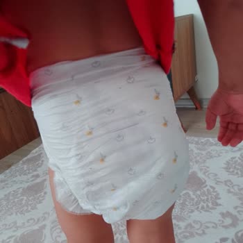 Sleepy No 6 Large Bebek Bezinde Kalite Sorunu