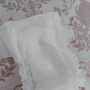 Sleepy No 6 Large Bebek Bezinde Kalite Sorunu