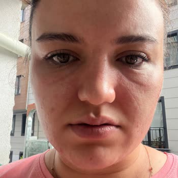 S'he Vec. Alerjik Tepkime Yaratan Yüz Yıkama Köpüğü