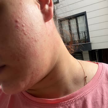 S'he Vec. Alerjik Tepkime Yaratan Yüz Yıkama Köpüğü