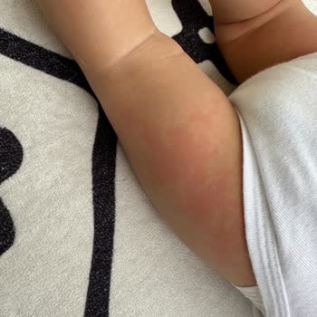 Argivit Şurup Şikayet Var