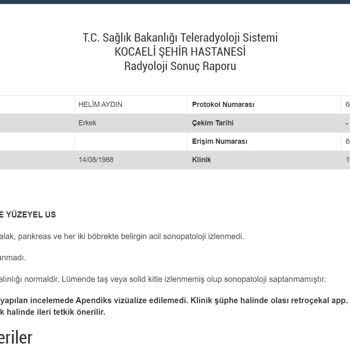 Türkiye Sigorta Ameliyat Karşılamıyor Red Cevabı Veriyor