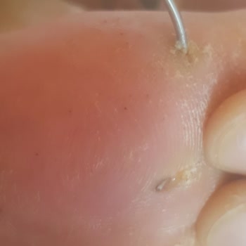 Sağlık Bakanlığı İlgisizlik Bastan Sağma Ve Sorumsuzluk