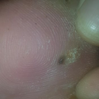 Sağlık Bakanlığı İlgisizlik Bastan Sağma Ve Sorumsuzluk