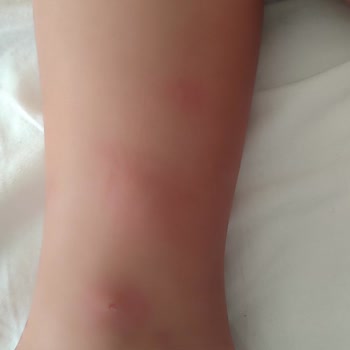 Liparis Resort Hotel Liparis Hotel Mersin