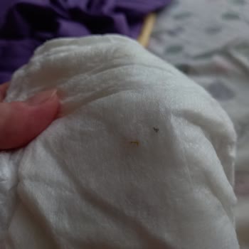 Sleepy Bebek Bezinden Çıkan Saçma Sert Bir Şey.