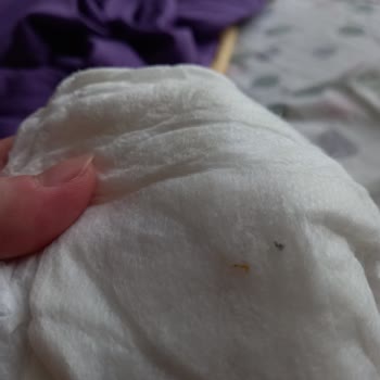 Sleepy Bebek Bezinden Çıkan Saçma Sert Bir Şey.